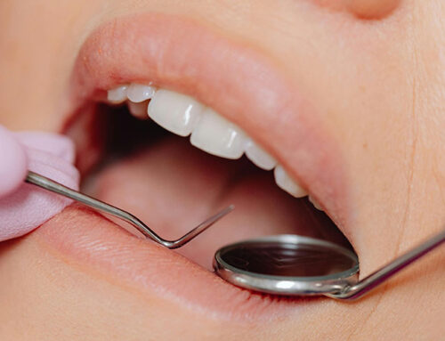 End-of-Year Teeth Cleaning: Why It’s Important