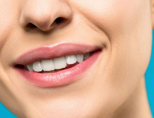 Professional Teeth Whitening vs. DIY: Which is Right for You?