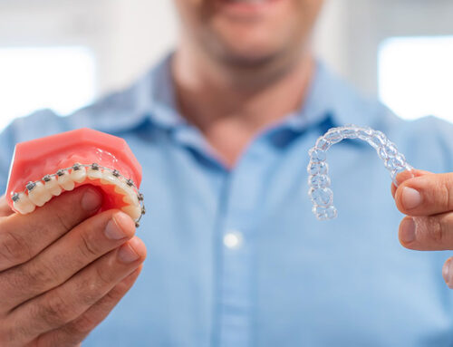 Is Invisalign Better Than Braces?